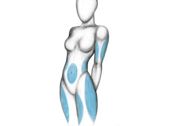 body lifts