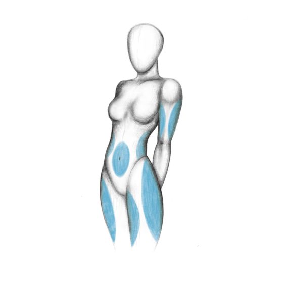 body lifts