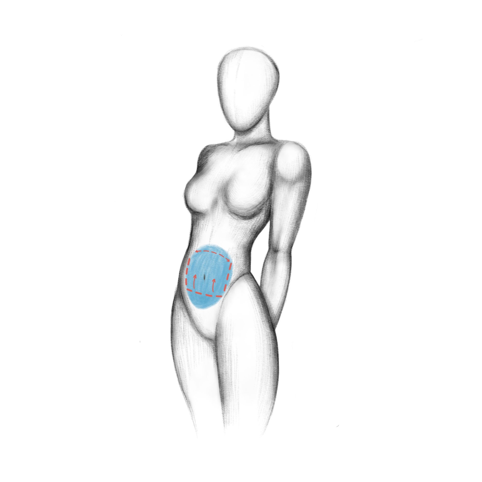 tummy tuck