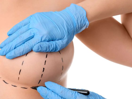 breast lift abroad